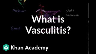 What is vasculitis  Circulatory System and Disease  NCLEXRN  Khan Academy [upl. by Mcquoid523]