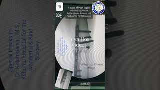 Arthrodesis knee  Post operative follow up  Adamya Hospital videos [upl. by Primavera]