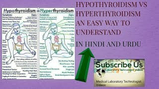 Hypothyroidism vs hyperthyroidism understand in hindi and urdu [upl. by Fielding]