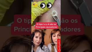 Linguado peixe com os 2 olhos do mesmo lado shorts [upl. by Laresa]