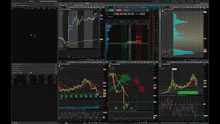 ThinkOrSwim Basic Setup [upl. by Ocsic]