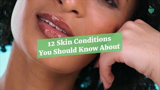 12 Skin Conditions You Should Know About [upl. by Ecyob]