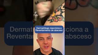 Extracción de absceso NO APROBADA por dermatólogos ⚠️ [upl. by Airamana]