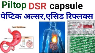 Piltop dsr capsule uses benifits precaution in hindihow to take and work piltop dsr capsuledsr cap [upl. by Tinya]