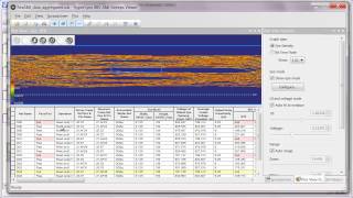 HyperLynx Support for DDR4 and LPDDR4 [upl. by Aivekahs]