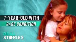 7 YearOlds Muscles Turn to Bone How Luciana Overcame FOP Rare Disease Documentary [upl. by Sylado]