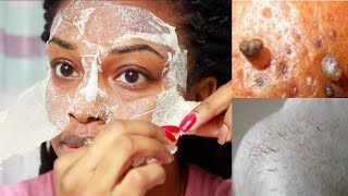 EASY DIY Egg Blackhead Remover Peel Off Mask [upl. by Asinla990]