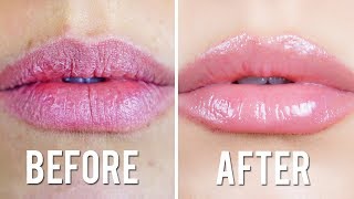 CHAPPED LIPS REMEDY [upl. by Darbie]