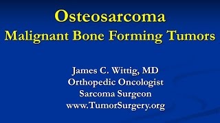 Orthopedic Oncology Course  Malignant Bone Forming Tumors Osteosarcoma  Lecture 4 [upl. by Annazus861]