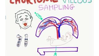 Chorionic Villus Sampling CVS Mnemonic [upl. by Ydnil]