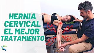 Como tratar una HERNIA DISCAL 🤩 cervical 👉 ejercicios  masaje  diatermia VOSSMAN Fisiolution [upl. by Siraj]