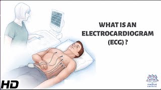 What Is An Electrocardiogram [upl. by Noiram542]