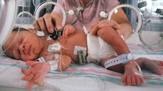 NICU Baby Sucking lips 👄 nicu nicubaby NICU Care Newborn Baby 👶 [upl. by Fedora]