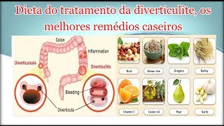 Dieta do tratamento da diverticulite os melhores remédios caseiros [upl. by Kramal536]