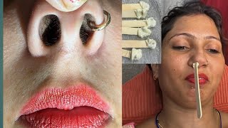 Nose hair waxingpiggynose nosepulling pummybeautyparlour pummybeautyworld [upl. by Pazia]