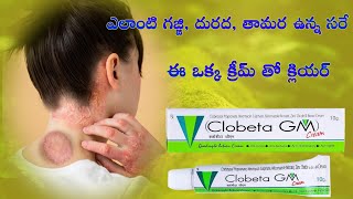 Clobeta GM cream uses in telugu  anti bacterial cream  antifungal cream  skin infection [upl. by Weathers736]