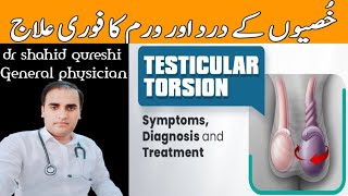 testicular torsion and its symptomstesticular torsion causestypesrisks and treatment [upl. by Eisned]