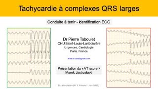 10d Tachycardie à QRS larges ECG Presentation du VT score Dr Taboulet [upl. by Stacie95]