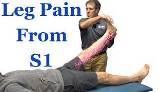 Leg Pain from S1 Nerve Root Compression Most COMMON Signs and Symptoms [upl. by Hamid]