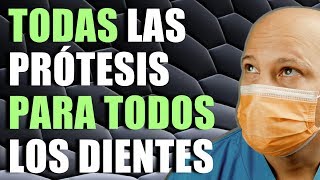 TIPOS de PRÓTESIS DENTALES cuando PERDEMOS TODOS los DIENTES [upl. by Naujak]