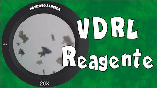 Teste de VDRL Reagente  Visto ao microscópio [upl. by Adler]