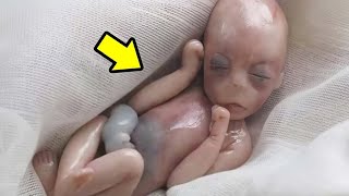 🛑The stillborn baby left everyone shocked😱 [upl. by Vudimir806]