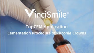 TopCEM Indirect Restoration  Cementation of Zirconia Crowns [upl. by Muiram]