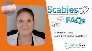 Dermatologist Answers Top FAQS about Scabies [upl. by Einnoc]