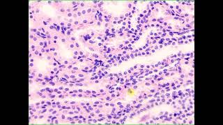 Simple cuboidal lining epithelium Kidney [upl. by Drof]