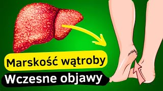 12 Pierwszych Objawów Uszkodzenia Wątroby  Przewodnik po Zdrowiu Wątroby [upl. by Deth]