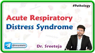 7 Acute Respiratory Distress Syndrome  USMLE Step 1 Pathology [upl. by Oleta]