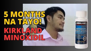 Week  20My Beard Journey with Kirkland Minoxidil beardgrowth Minoxidil Kirkland Howto [upl. by Cara6]