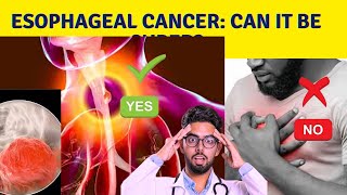 What is the survival rate for esophageal cancer [upl. by Secilu]