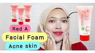 Review REDA Facial Foam  Facial Wash untuk Kulit Berjerawat dan Bruntusan  By Vapinka Makeup [upl. by Aisinut]