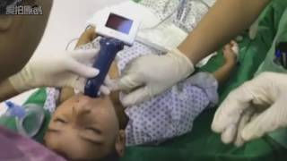 Pediatric Operation intubation laryngoscope [upl. by Greenland21]