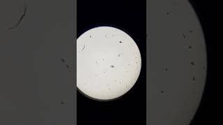 Microorganisms under microscope shorts [upl. by Adiarf]