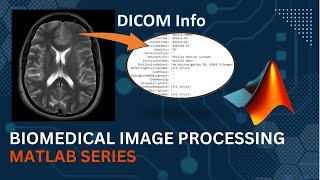 Getting Info of DICOM file  MATLAB  Medical Image Processing [upl. by Gniw]