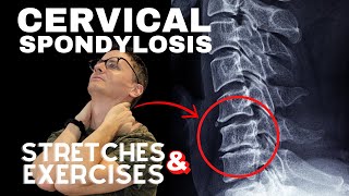 Cervical Spondylosis Neck Arthritis Stretches amp Exercises  Dr Jon Saunders [upl. by Frans]