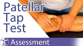 Patellar Tap Test  Ballottement Test⎟Knee Swelling [upl. by Drawyah]