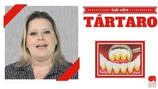 Tartaro Como acabar com o Tártaro nos Dentes [upl. by Llennol530]