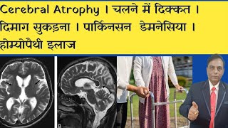 Cerebral Atrophy । चलने में दिक्कत । दिमाग सुकड़ना । पार्किनसन । डेमनेसिया । होम्योपैथी इलाज [upl. by Aiciruam]