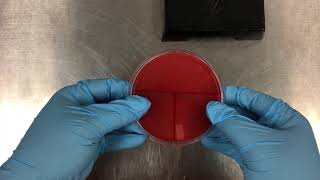 Petri Dish Inoculation  Streak Method [upl. by Hak]