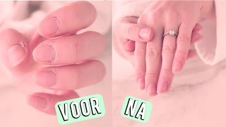 Snel droge handen en nagelriemen verzorgen  Beautygloss [upl. by Ocker922]