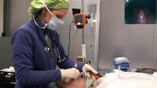 Video laryngoscope Tracheal intubation with Bougie Port [upl. by Atik]