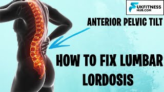 How To Fix Lumbar Lordosis and Anterior Pelvic Tilts  Full Exercise and Stretch Plan [upl. by Marci]