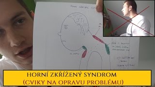 Jak opravit nechutný želví krk Horní zkřížený syndrom [upl. by Romanas]