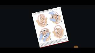 lec58 Obstratics LHV Diagnosis of Breech presentation الٹے بچے کی تشخیص کرنا [upl. by Polish485]