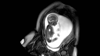 Foetal Development Unborn Baby Movement at 24 Weeks  WIRED [upl. by Tnilk232]