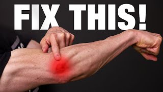 How to Fix Tennis Elbow PERMANENTLY [upl. by Laram365]