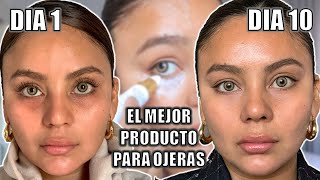 ELIMINO OJERAS EN 10 DIAS LA CREMA 1 DEL MUNDO DEMARTOLOGICO [upl. by Dalis]